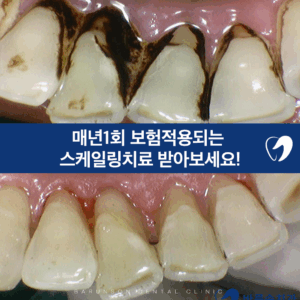 발곡역치과