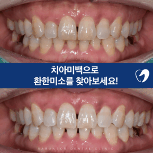 신곡동치과