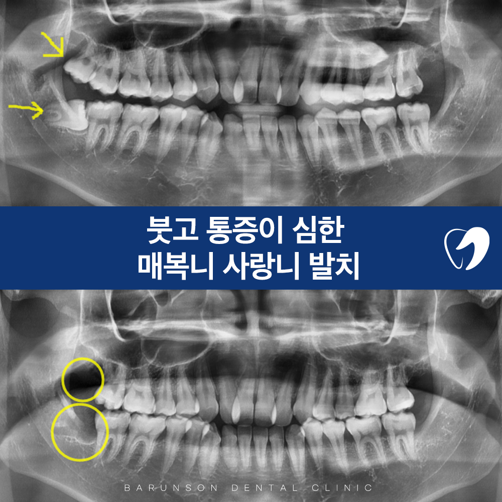 의정부치과