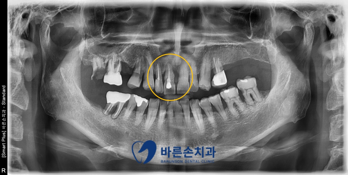 신곡동임플란트