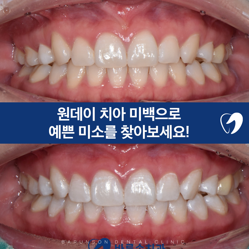 의정부치과