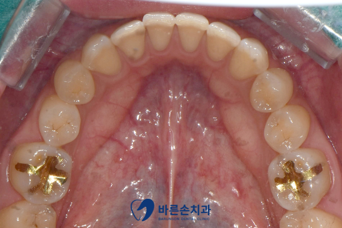 신곡동치과