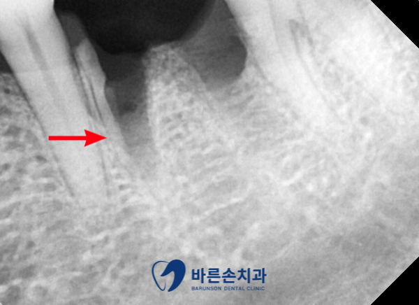 신곡동임플란트