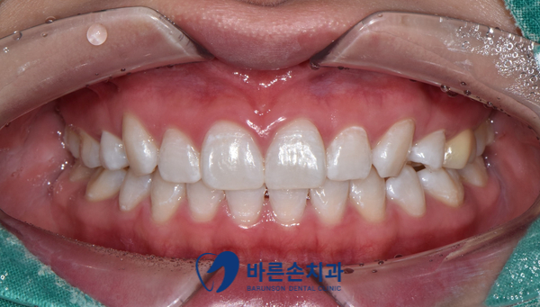 의정부치과
