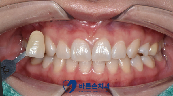 의정부치과