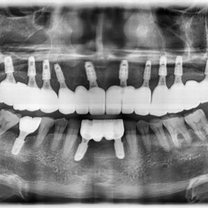 김원식_20260102_110644