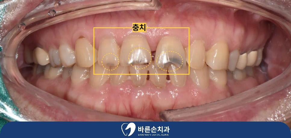 의정부치과