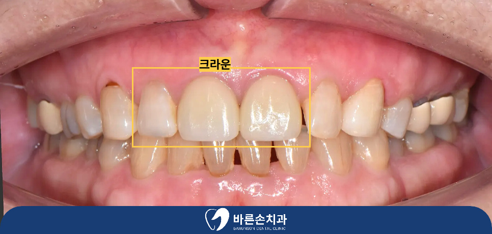 의정부치과