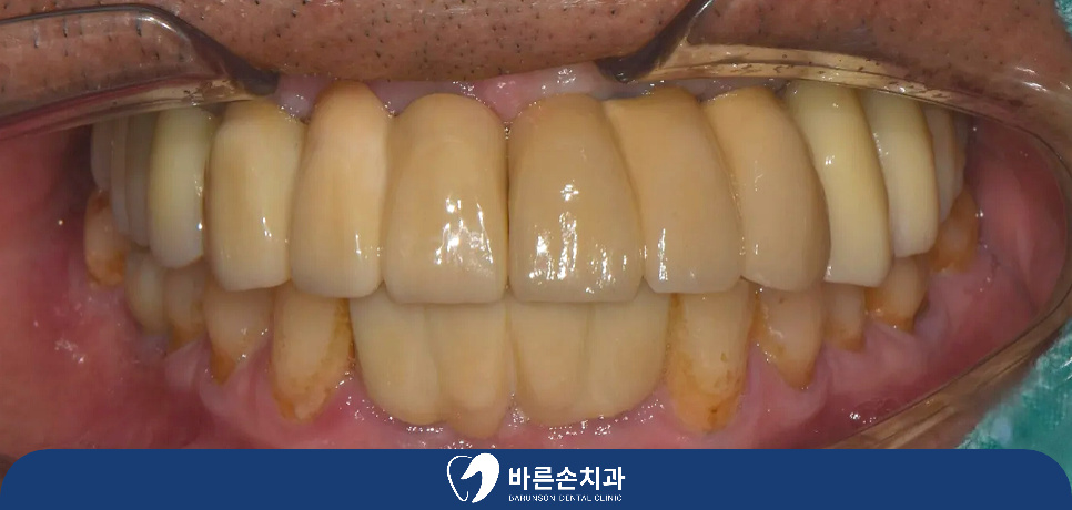 신곡동치과