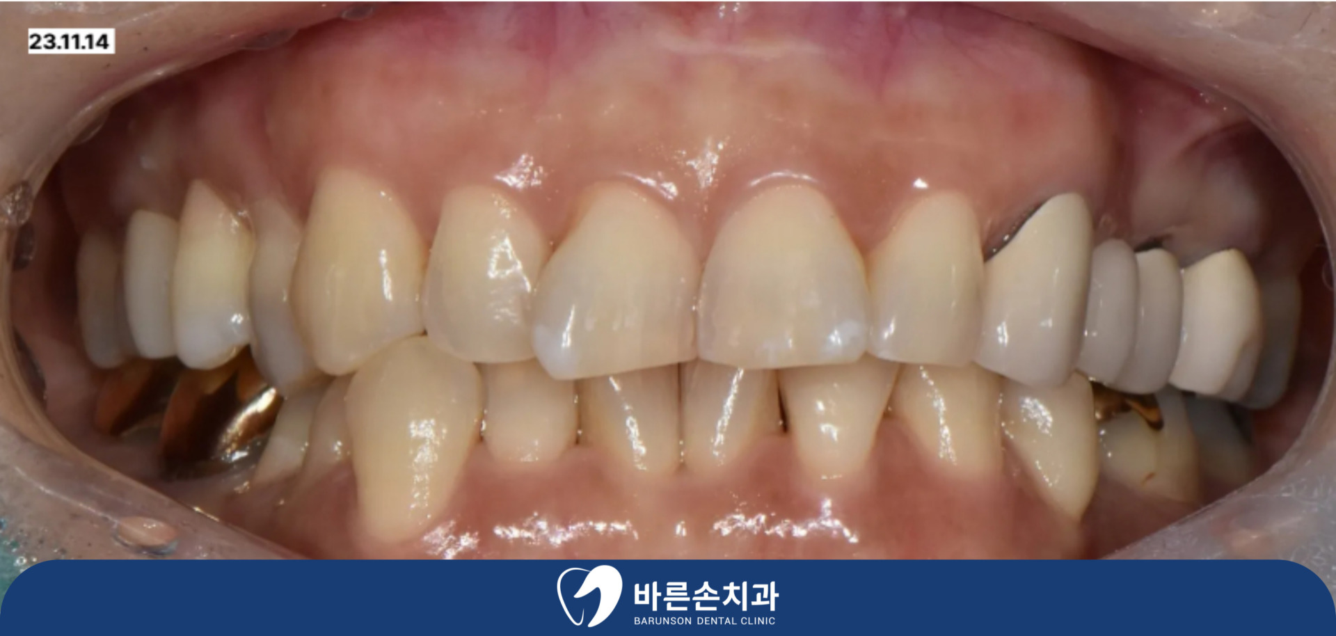 신곡동치과