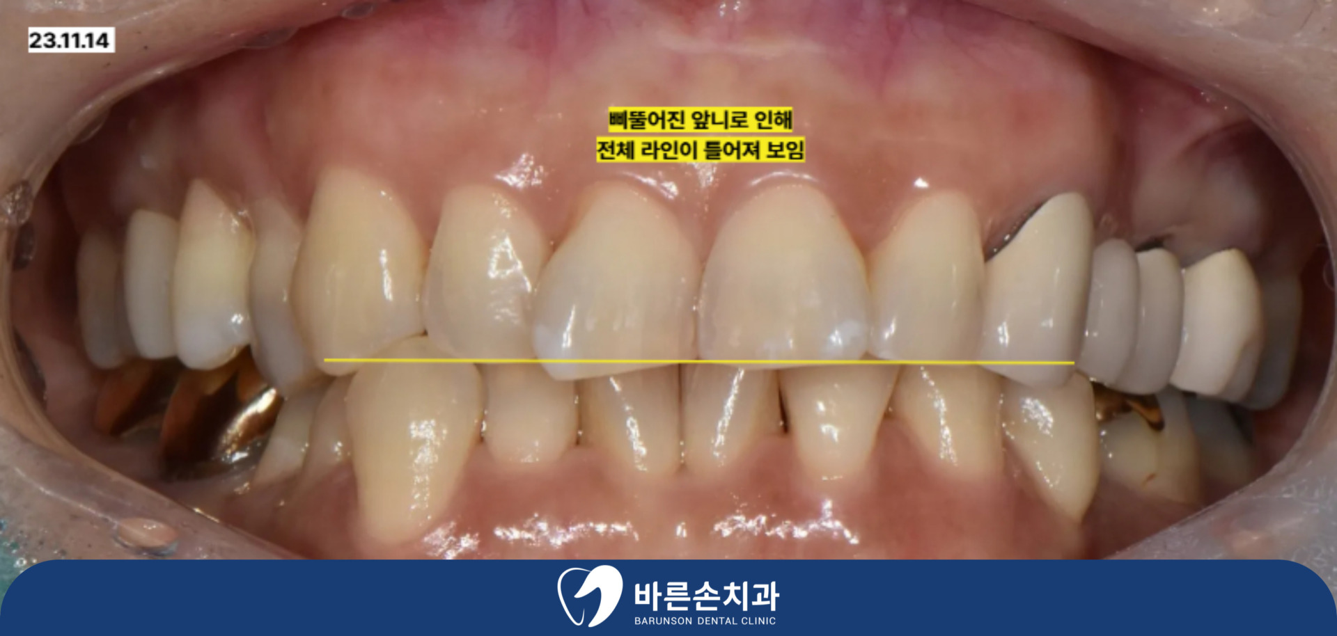 신곡동치과