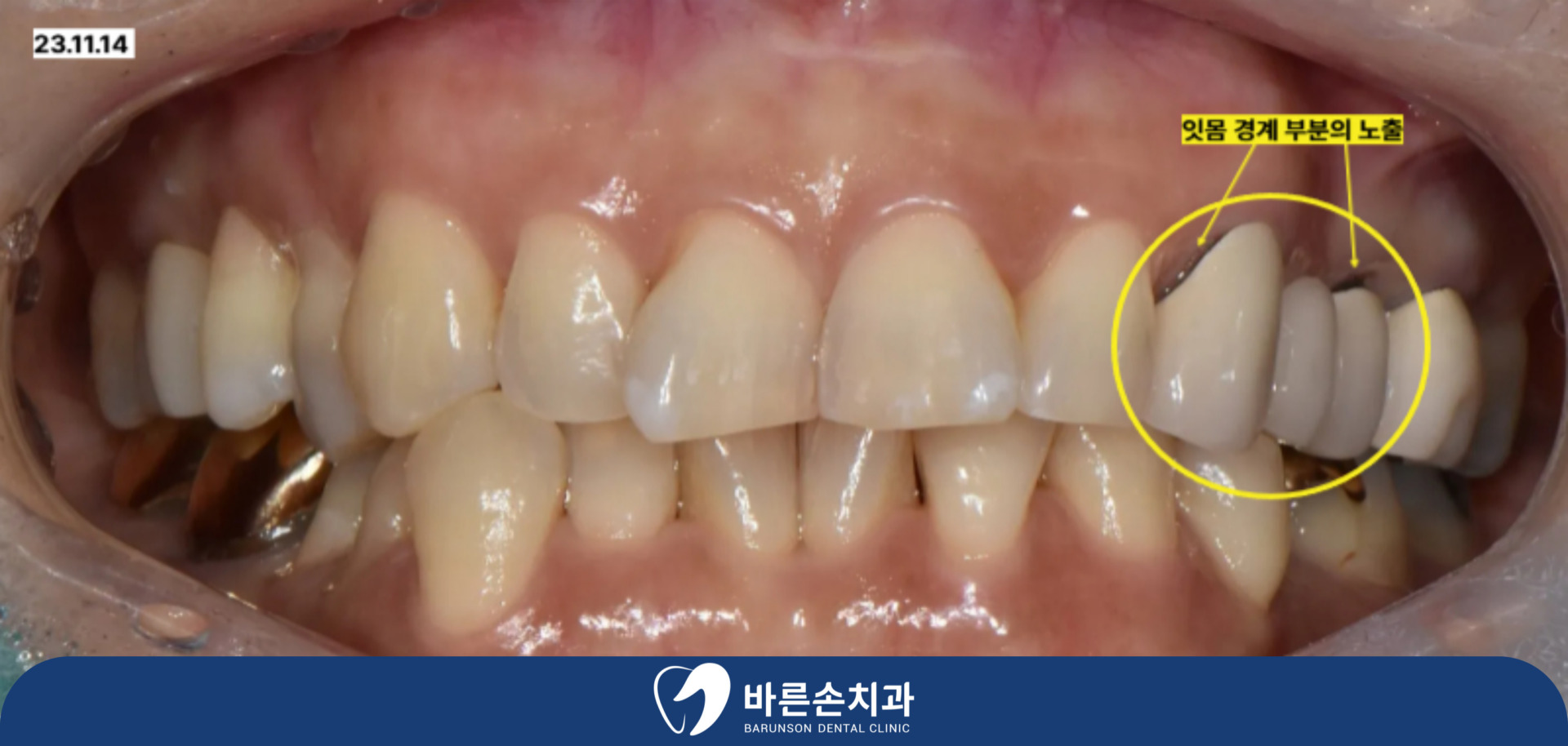 신곡동치과