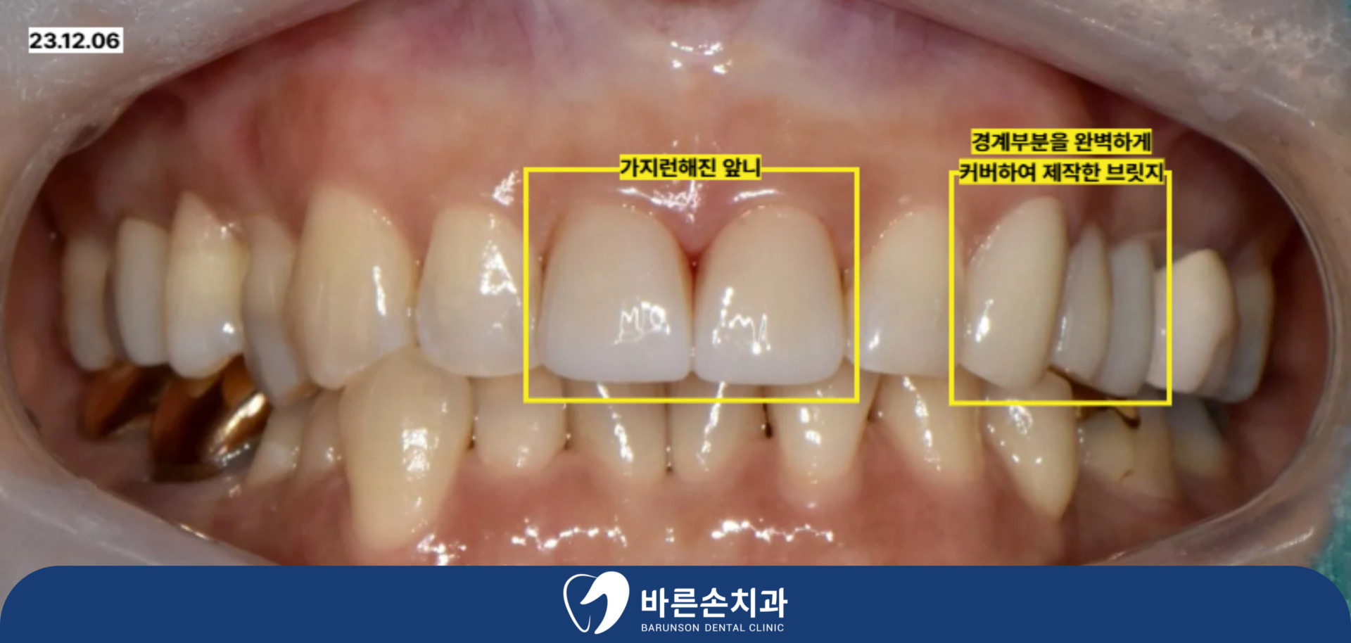 신곡동치과