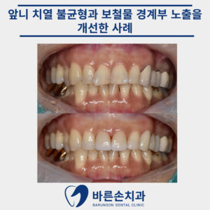 신곡동치과