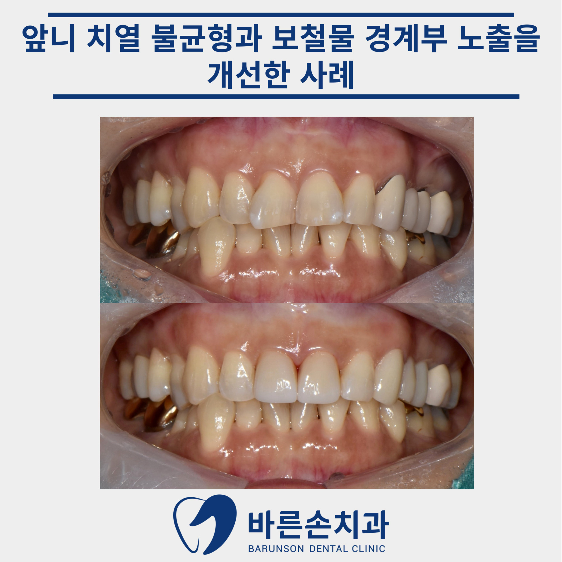 신곡동치과