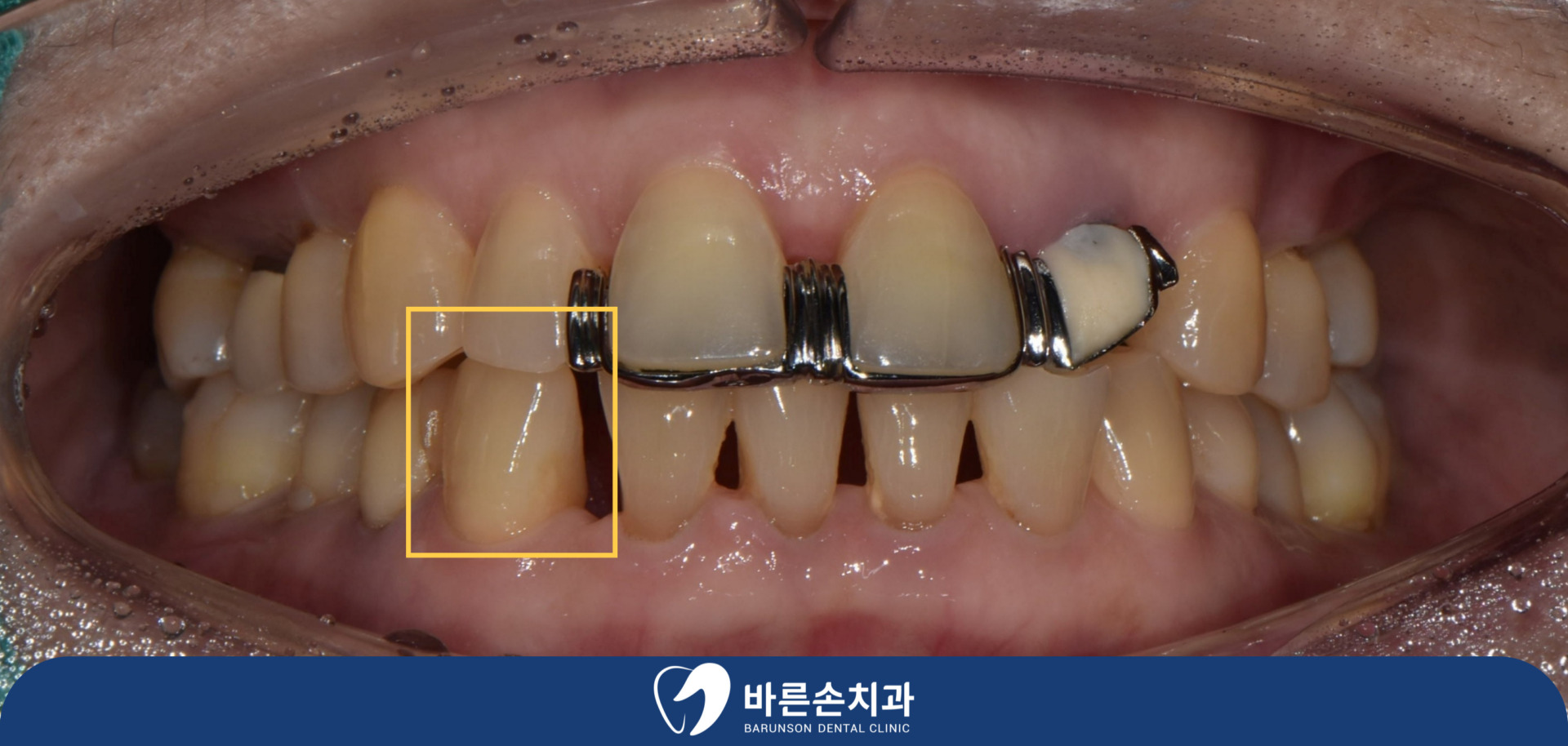 신곡동치과