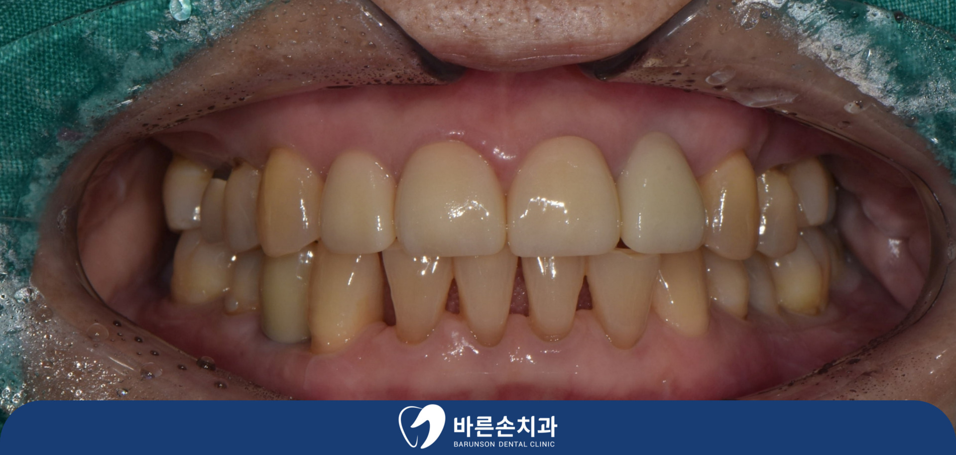 신곡동치과