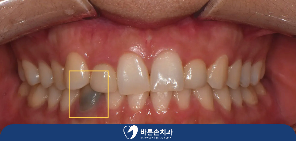 발곡역치과