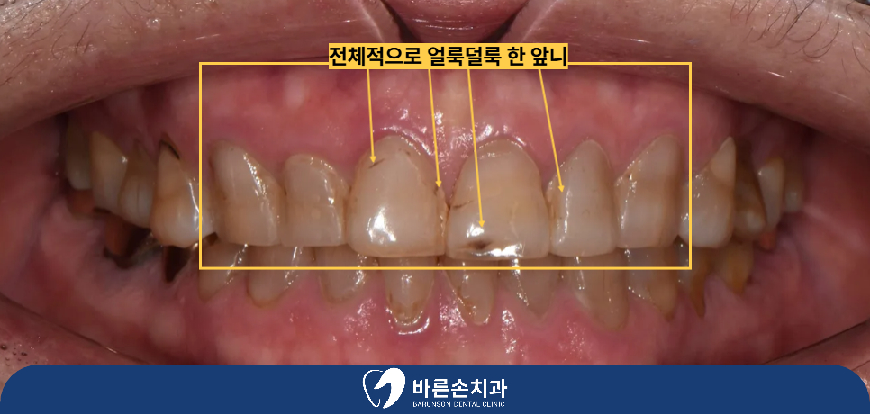 의정부치과