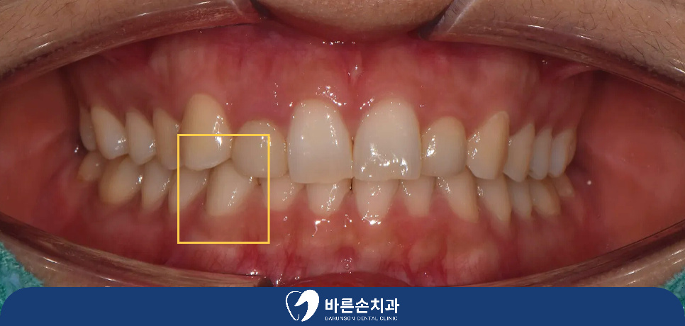 발곡역치과