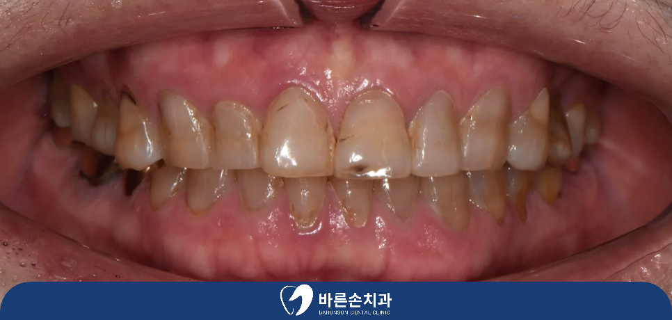 의정부치과