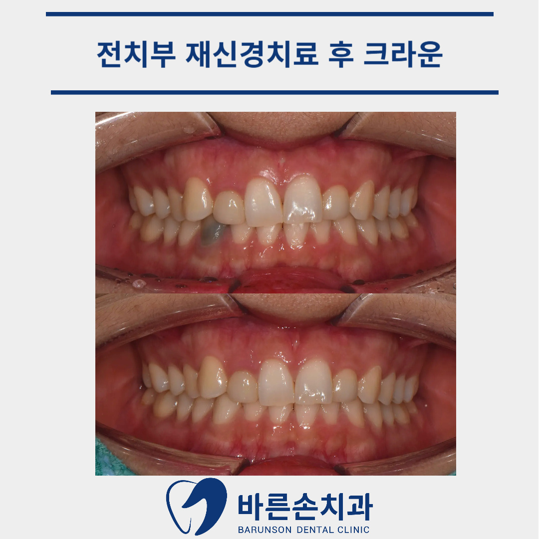 발곡역치과