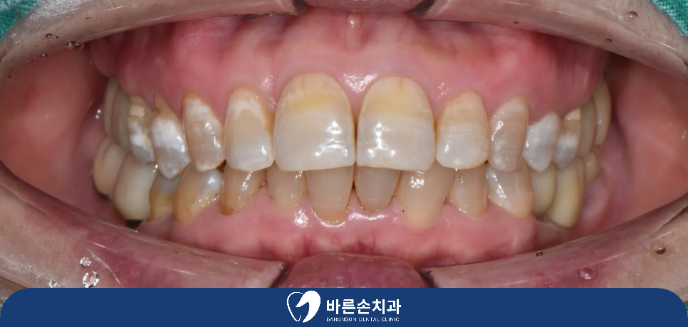 신곡동치과