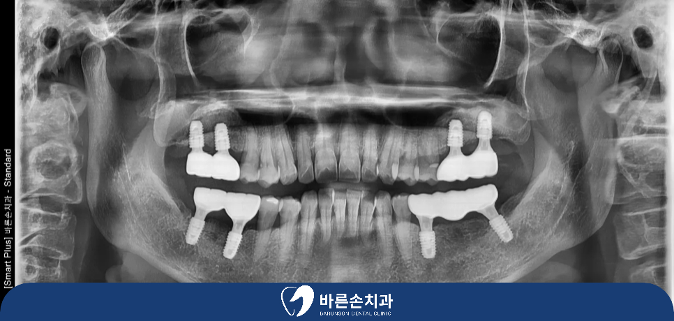 신곡동치과