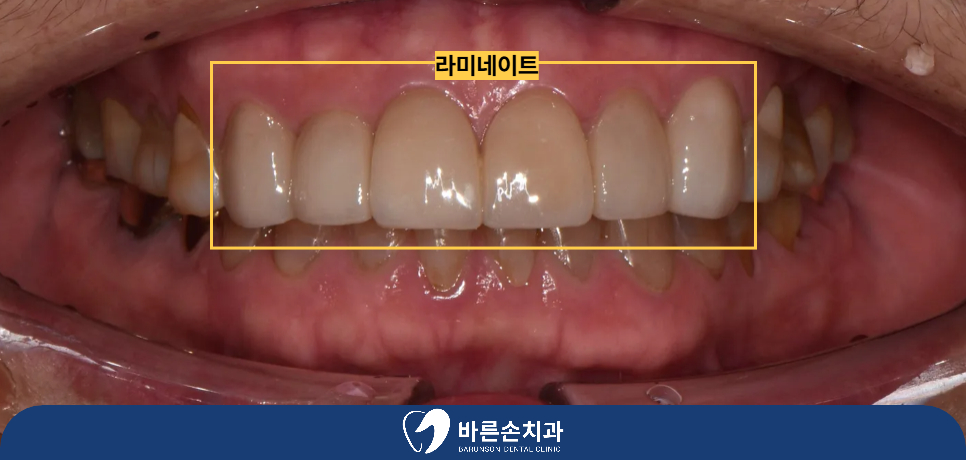 의정부치과