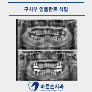 신곡동치과