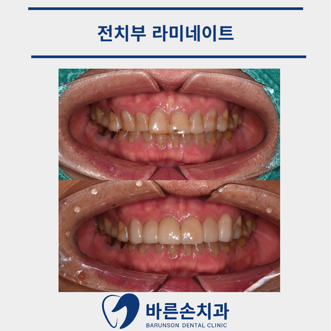 의정부치과