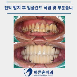 신곡동치과