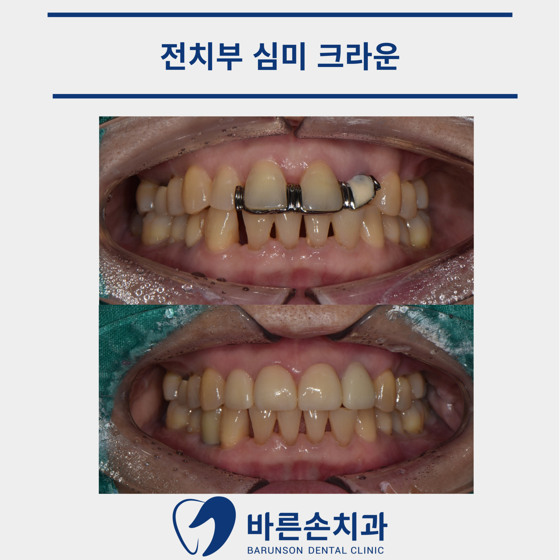 신곡동치과