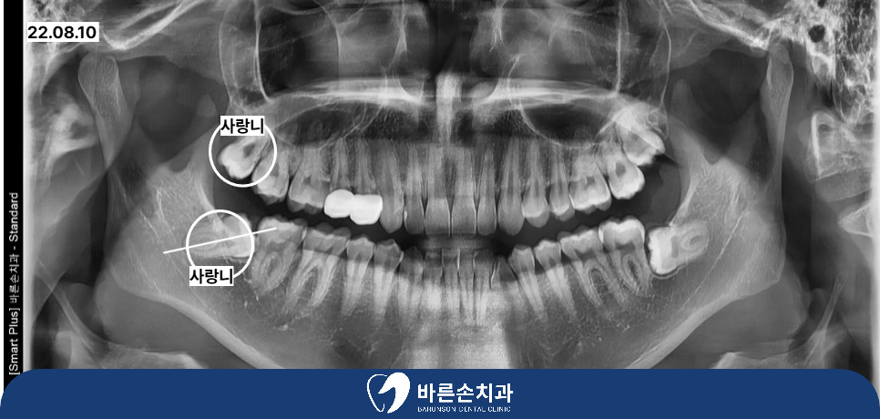 의정부치과