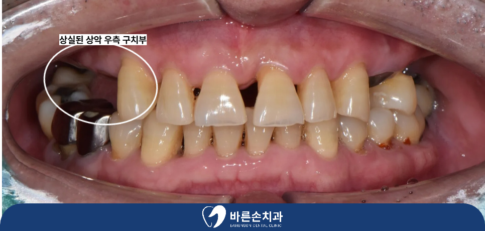 발곡역치과