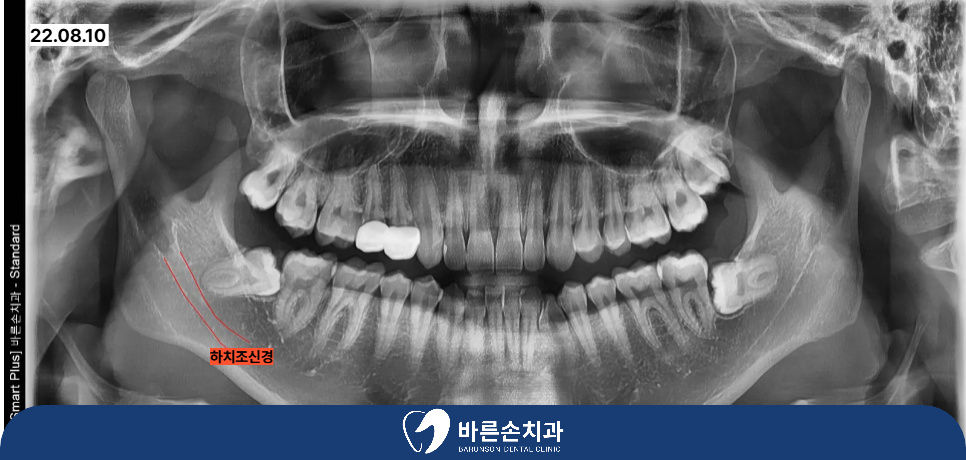 의정부치과