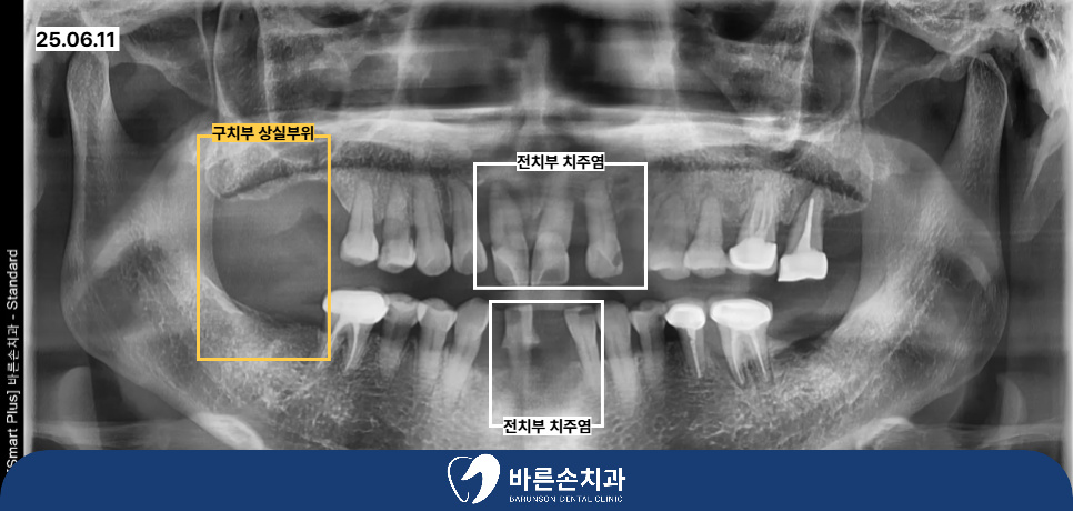 신곡동임플란트