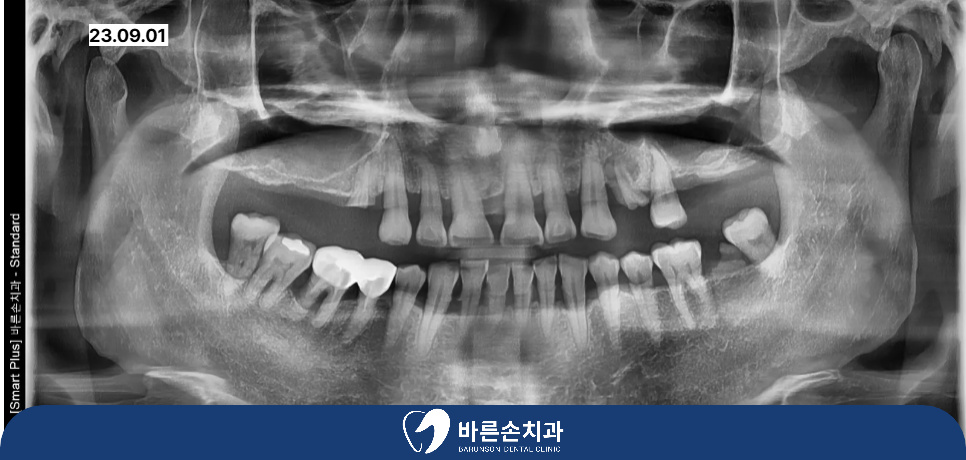 발곡역치과