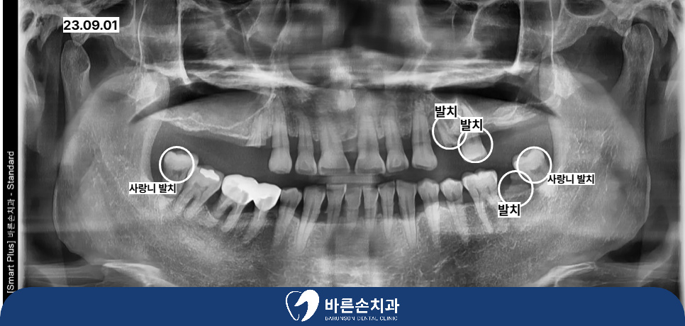 발곡역치과