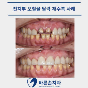 의정부치과