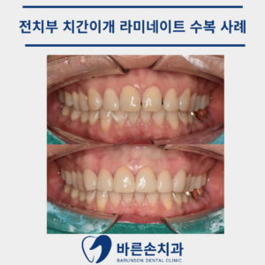 신곡동치과