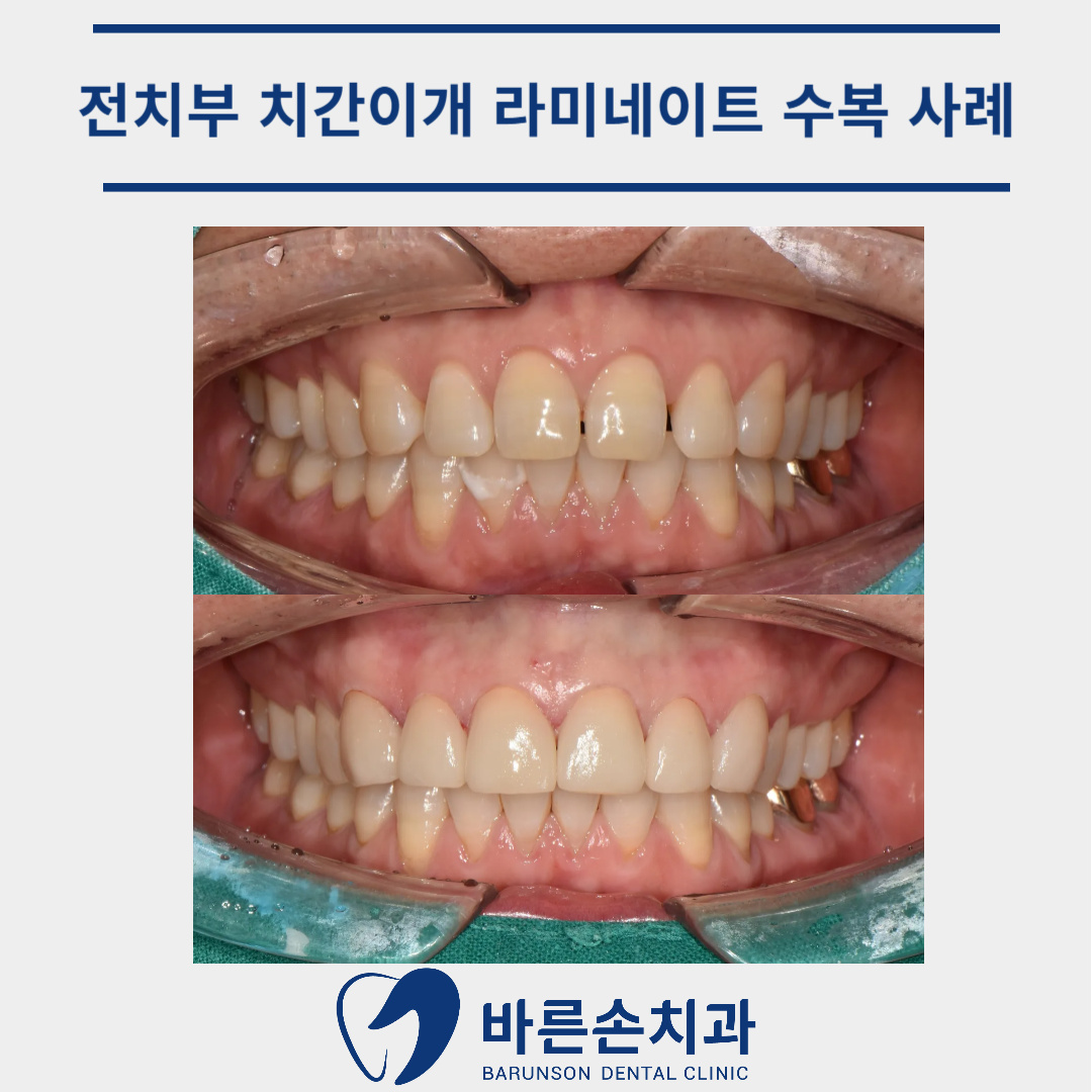 신곡동치과