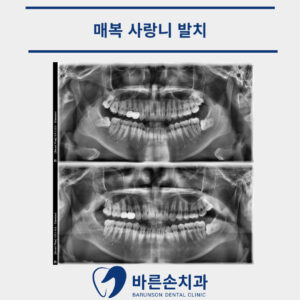 의정부치과