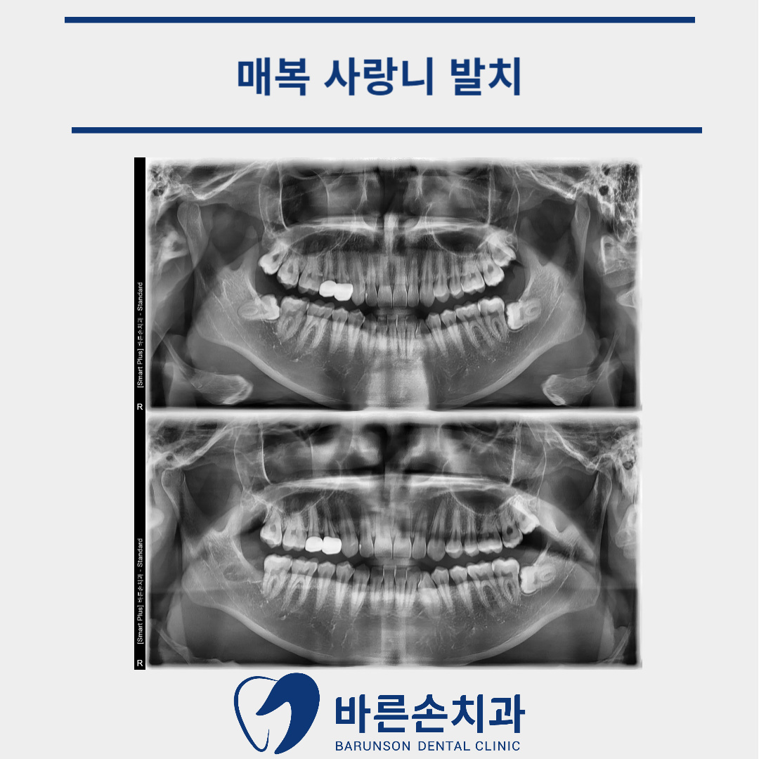 의정부치과
