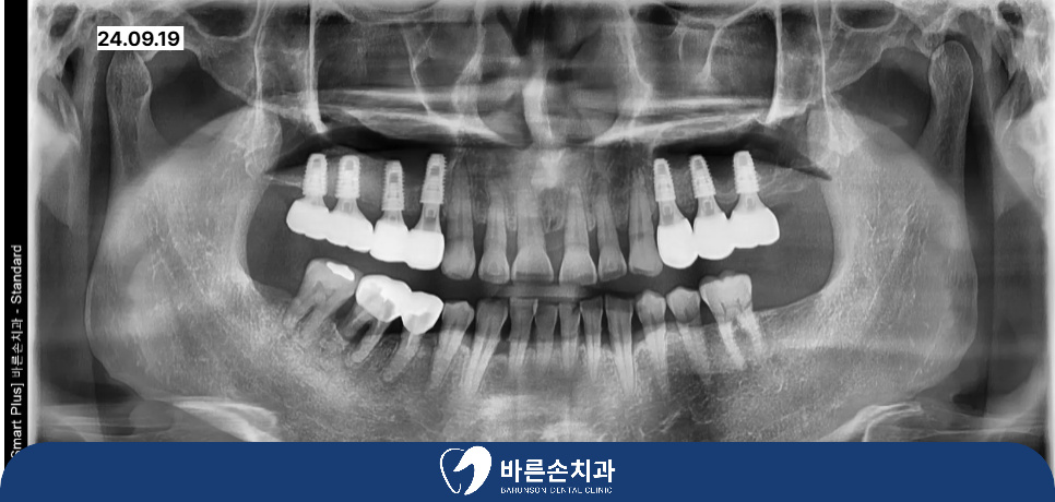 발곡역치과