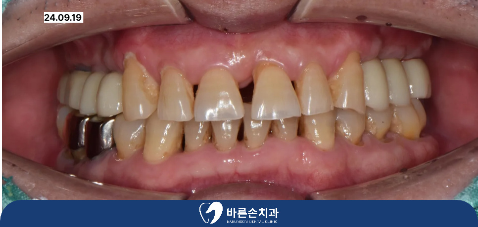 발곡역치과