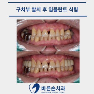 발곡역치과