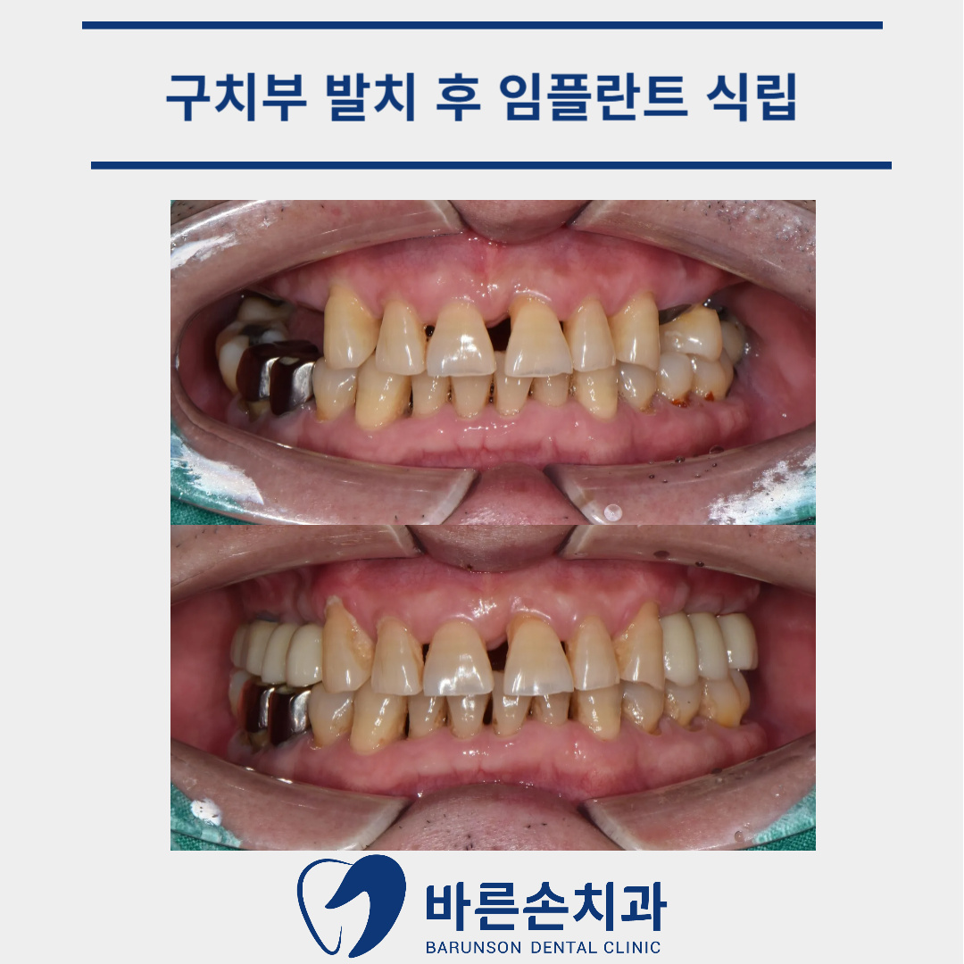 발곡역치과