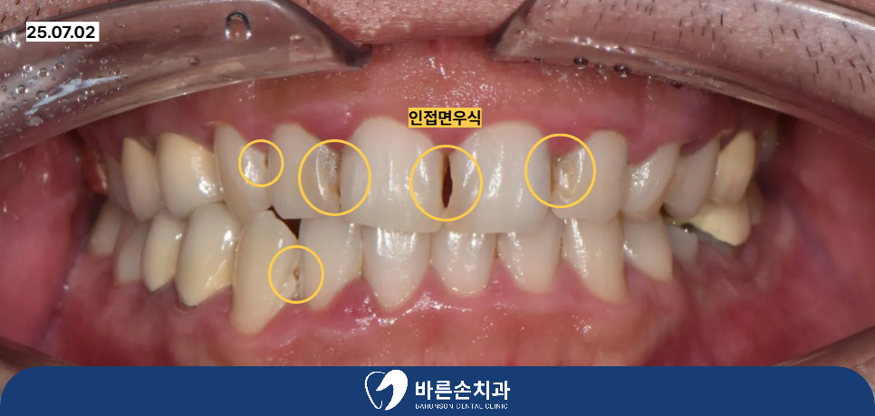 발곡역치과
