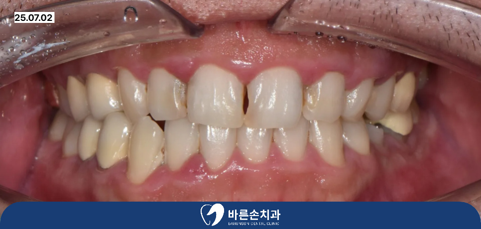발곡역치과